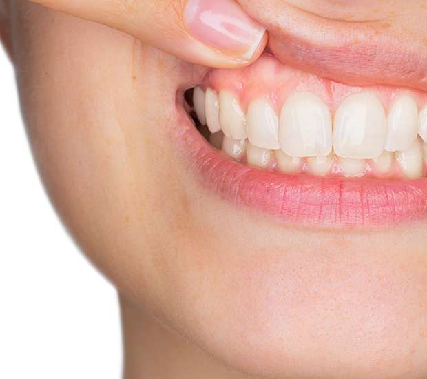 El Cajon Gum Disease