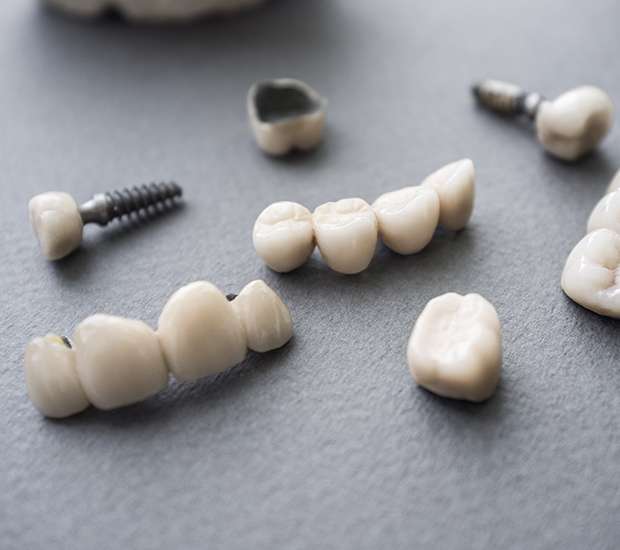 El Cajon The Difference Between Dental Implants and Mini Dental Implants