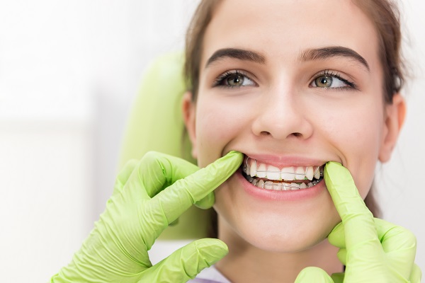 Orthodontics: How To Improve Your Smile Through Teeth Straightening
