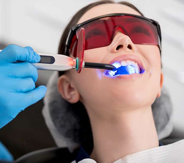 El Cajon Professional Teeth Whitening
