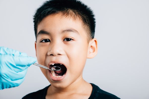 How Tooth Sealants Save Your Natural Teeth